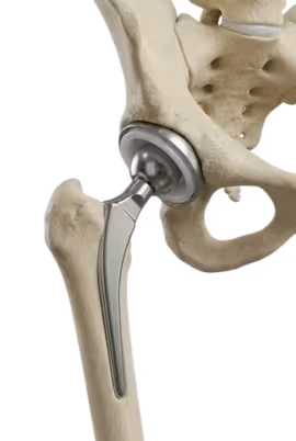 Home 15 Advanced Hip Replacement